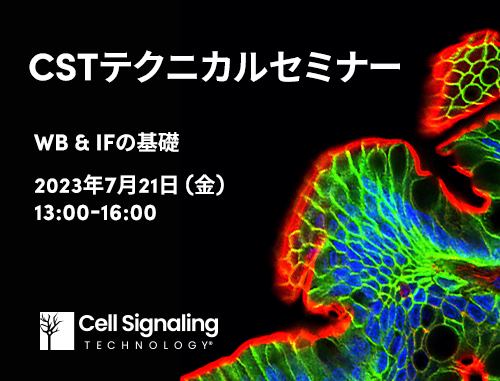 CSTが抗体の社内検証で培った知識をセミナーでお届けします！