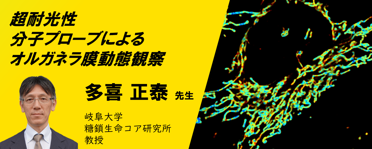 『受賞者の今』NIKON JOICO AWARDシリーズウェビナー第1回：超耐光性 分子プローブによる オルガネラ膜動態観察