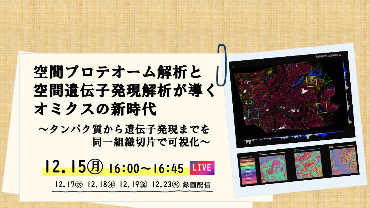 空間プロテオーム解析と空間遺伝子発現解析が導くオミクスの新時代 ～タンパク質から遺伝子発現までを同一組織切片で可視化～